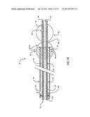 Embolic Protection Device Having Expandable Trap diagram and image