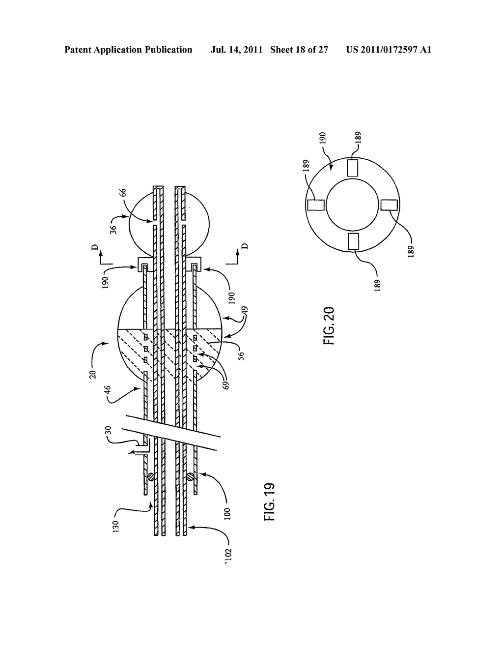 Embolic Protection Device Having Expandable Trap - diagram, schematic, and image 19