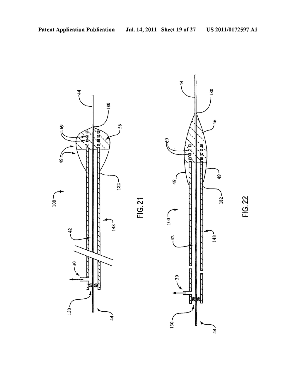 Embolic Protection Device Having Expandable Trap - diagram, schematic, and image 20