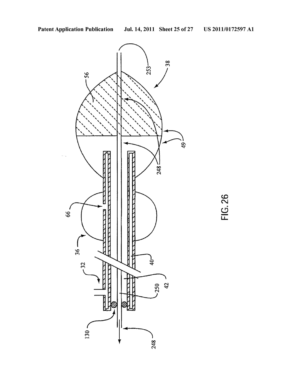 Embolic Protection Device Having Expandable Trap - diagram, schematic, and image 26