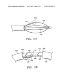 CONTROL SYSTEM AND PROCESS FOR APPLICATION OF ENERGY TO AIRWAY WALLS AND     OTHER MEDIUMS diagram and image