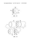 Conduit Harvesting Instrument and Method diagram and image