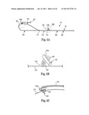 INTERVERTEBRAL DISC ANNULUS REPAIR SYSTEM AND METHOD diagram and image