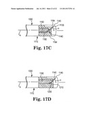 INTERVERTEBRAL DISC ANNULUS REPAIR SYSTEM AND METHOD diagram and image