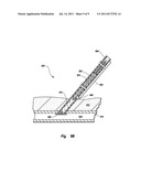 TISSUE PUNCTURE CLOSURE DEVICE WITH AUTOMATIC TAMPING diagram and image