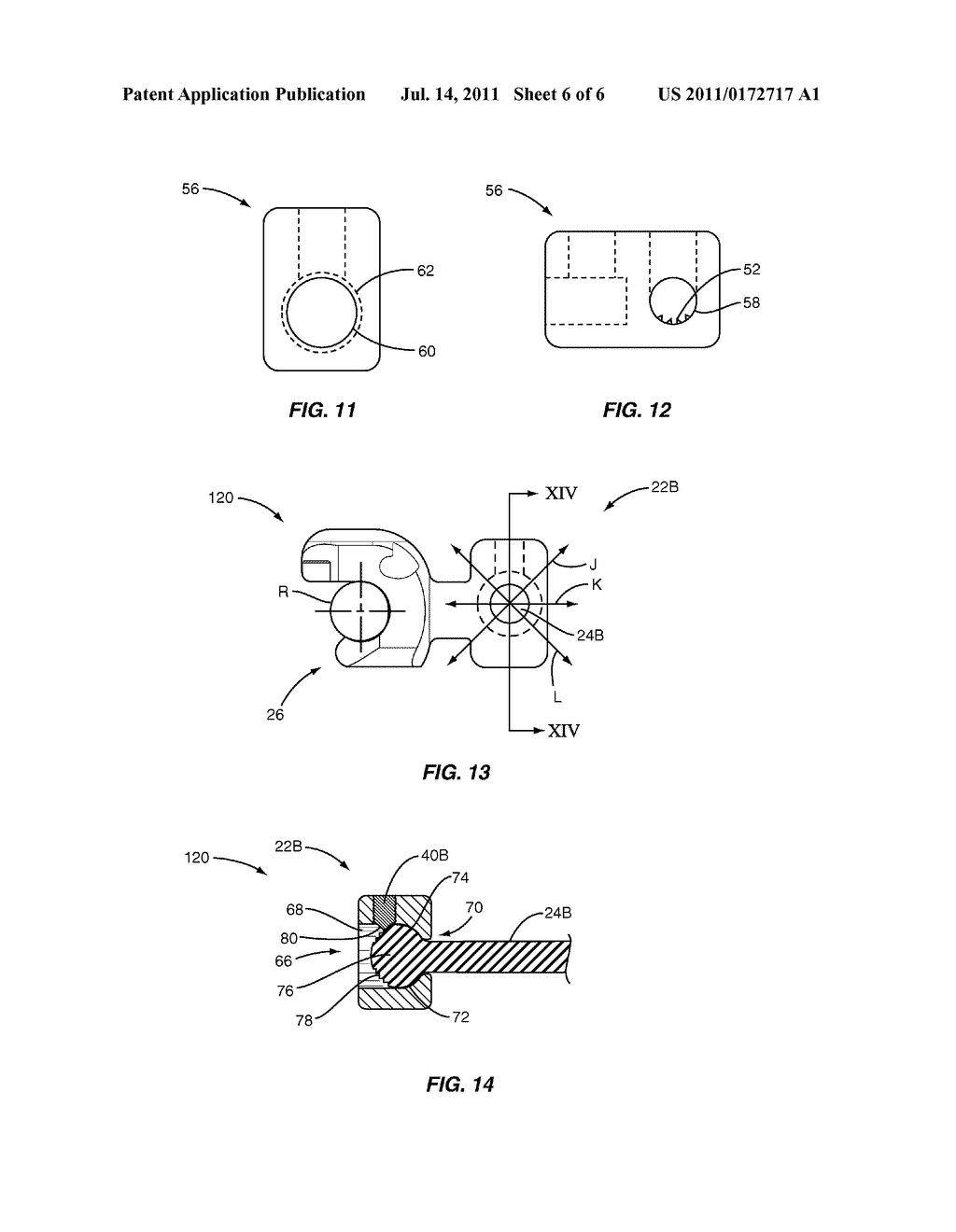 Spinal Rod Extenders and Methods of Use - diagram, schematic, and image 07