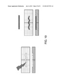 ORTHOPEDIC IMPLANTS FOR USE WITH PRECISION BONE RESURFACING     INSTRUMENTATION diagram and image