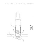 Door breaching projectile system diagram and image