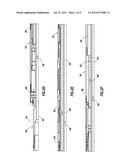 FRACTURING/GRAVEL PACKING TOOL SYSTEM WITH DUAL FLOW CAPABILITIES diagram and image