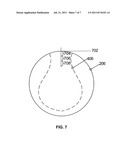 Refractive-Diffractive Multifocal Lens diagram and image