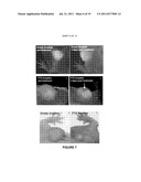 STABLE NANOEMULSIONS FOR ULTRASOUND-MEDIATED DRUG DELIVERY AND IMAGING diagram and image