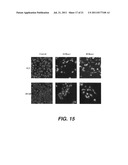 TARGETING PAX2 FOR THE INDUCTION OF DEFB1-MEDIATED TUMOR IMMUNITY AND     CANCER THERAPY diagram and image