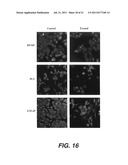 TARGETING PAX2 FOR THE INDUCTION OF DEFB1-MEDIATED TUMOR IMMUNITY AND     CANCER THERAPY diagram and image