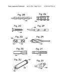 Ceramic articles and methods diagram and image