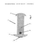 IMPLANTABLE FLUID MANAGEMENT SYSTEM FOR THE REMOVAL OF EXCESS FLUID diagram and image