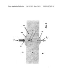 IMPLANTABLE FLUID MANAGEMENT SYSTEM FOR THE REMOVAL OF EXCESS FLUID diagram and image