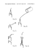 MEDICAL ATTACHMENT DEVICE diagram and image