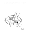 MEDICAL ATTACHMENT DEVICE diagram and image