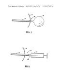 Shunt Apparatus For Treating Obesity By Extracting Food diagram and image