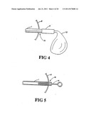 Shunt Apparatus For Treating Obesity By Extracting Food diagram and image