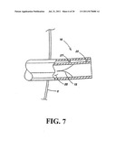 Shunt Apparatus For Treating Obesity By Extracting Food diagram and image