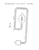 Shunt Apparatus For Treating Obesity By Extracting Food diagram and image