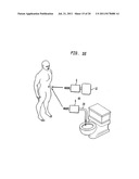 Shunt Apparatus For Treating Obesity By Extracting Food diagram and image