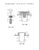 Shunt Apparatus For Treating Obesity By Extracting Food diagram and image