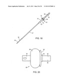 Shunt Apparatus For Treating Obesity By Extracting Food diagram and image