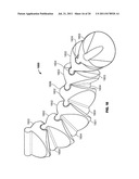 ROTARY-RIGID ORTHOPAEDIC ROD diagram and image