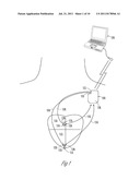 PACING AND SENSING VECTORS diagram and image