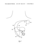 PACING AND SENSING VECTORS diagram and image