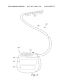 TORQUE LOCK ANCHOR AND METHODS AND DEVICES USING THE ANCHOR diagram and image