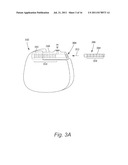 TORQUE LOCK ANCHOR AND METHODS AND DEVICES USING THE ANCHOR diagram and image