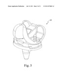 KNEE PROSTHESIS SYSTEM diagram and image