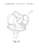 KNEE PROSTHESIS SYSTEM diagram and image