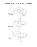 TIBIAL COMPONENTS FOR A KNEE PROSTHESIS SYSTEM diagram and image