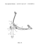 ADJUSTABLE CONDUIT COUPLING ASSEMBLY diagram and image