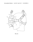 ADJUSTABLE CONDUIT COUPLING ASSEMBLY diagram and image