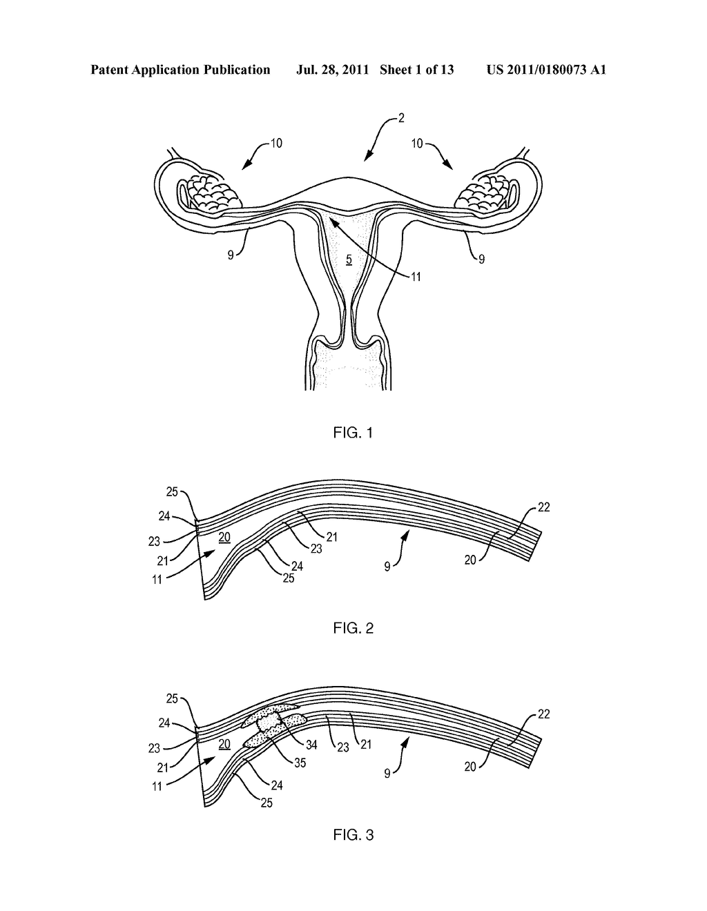 Sterilization Device and Method - diagram, schematic, and image 02