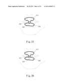 ADJUSTABLE ORAL INTERFACE AND METHOD TO MAINTAIN UPPER AIRWAY PATENCY diagram and image