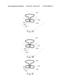 ADJUSTABLE ORAL INTERFACE AND METHOD TO MAINTAIN UPPER AIRWAY PATENCY diagram and image