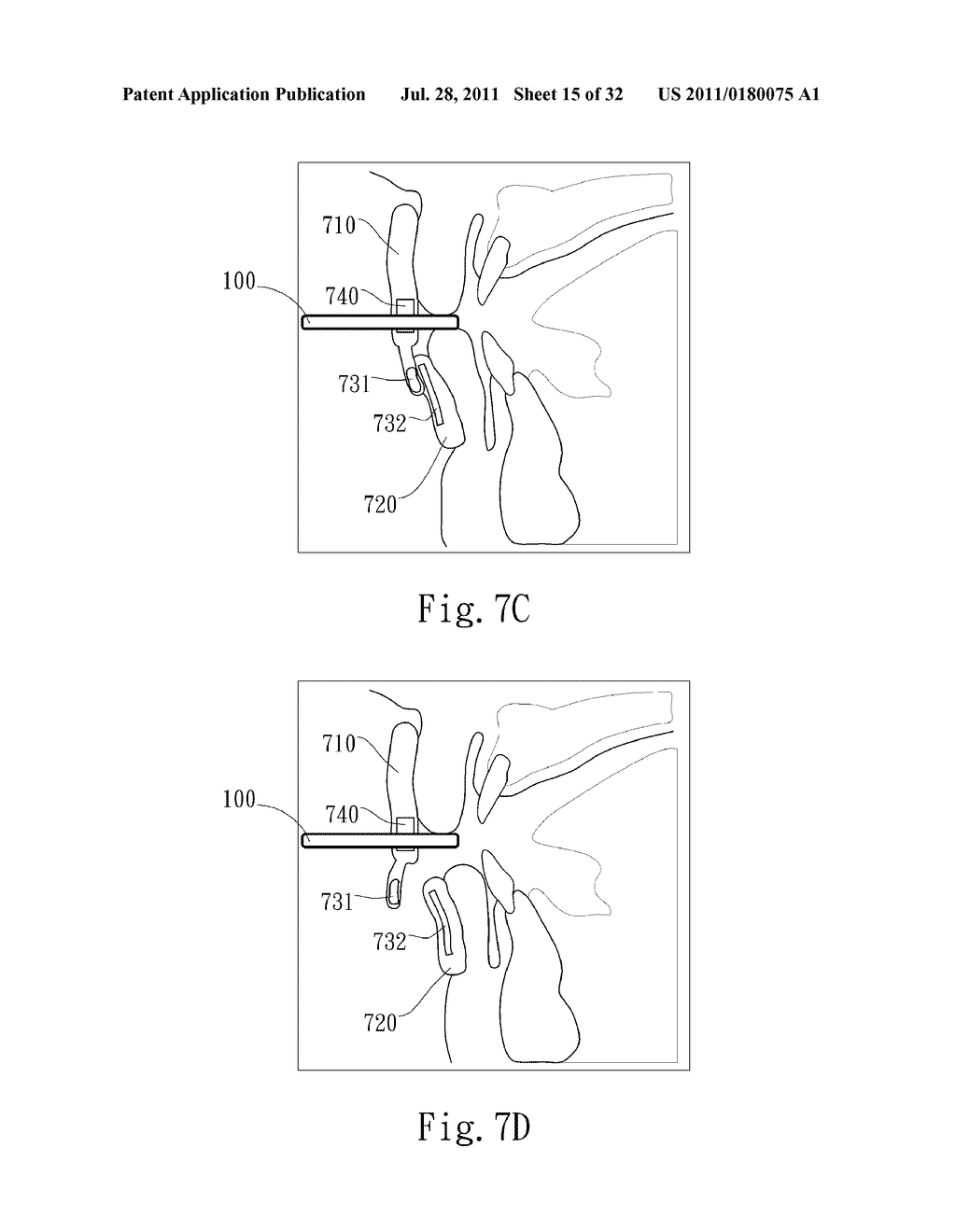 ADJUSTABLE ORAL INTERFACE AND METHOD TO MAINTAIN UPPER AIRWAY PATENCY - diagram, schematic, and image 16