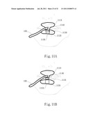 ADJUSTABLE ORAL INTERFACE AND METHOD TO MAINTAIN UPPER AIRWAY PATENCY diagram and image