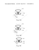 ADJUSTABLE ORAL INTERFACE AND METHOD TO MAINTAIN UPPER AIRWAY PATENCY diagram and image