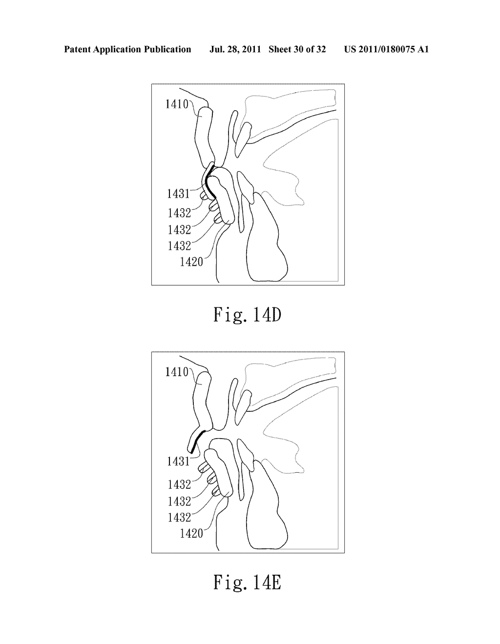 ADJUSTABLE ORAL INTERFACE AND METHOD TO MAINTAIN UPPER AIRWAY PATENCY - diagram, schematic, and image 31