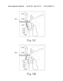 ADJUSTABLE ORAL INTERFACE AND METHOD TO MAINTAIN UPPER AIRWAY PATENCY diagram and image