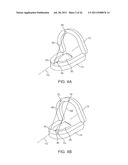 WEARABLE TISSUE RETENTION DEVICE diagram and image