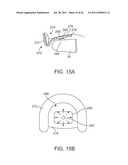 WEARABLE TISSUE RETENTION DEVICE diagram and image