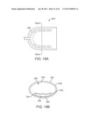 WEARABLE TISSUE RETENTION DEVICE diagram and image